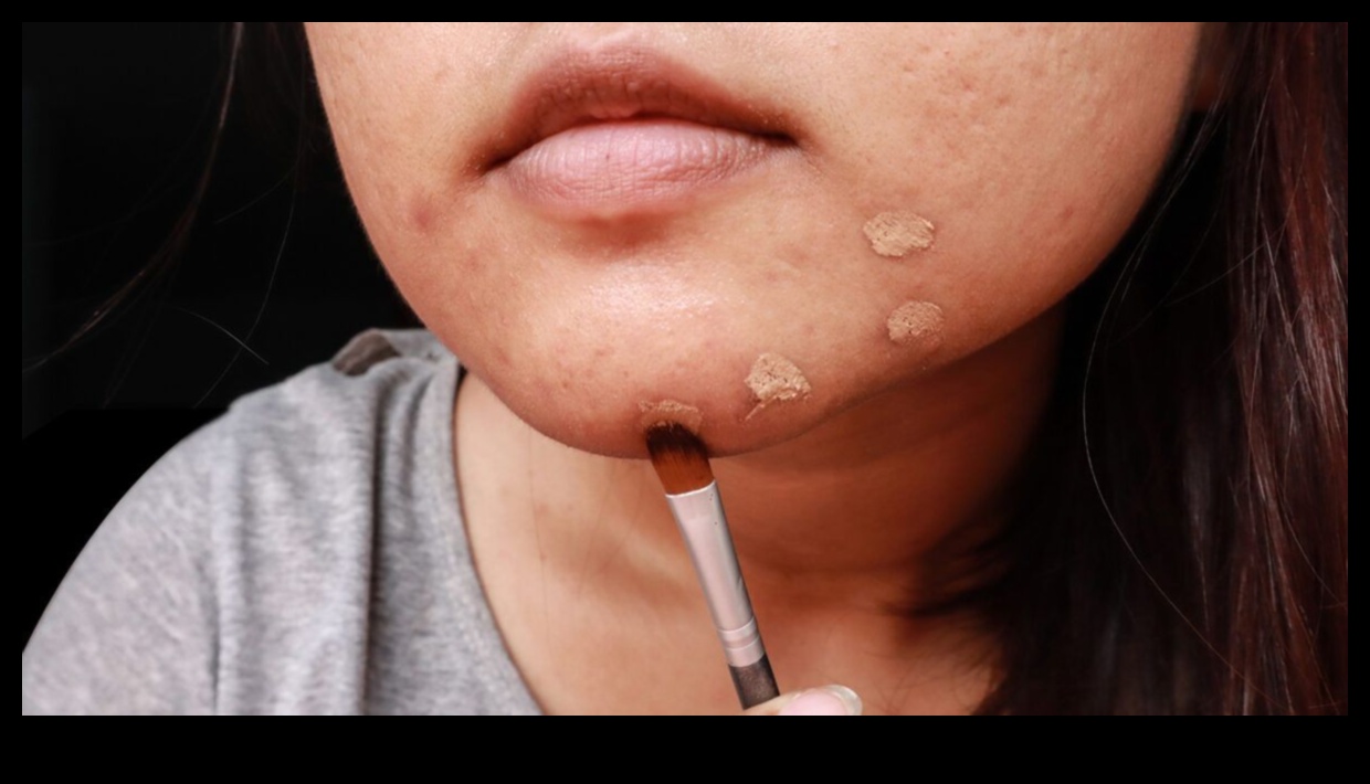 المخفي وحب الشباب: كيفية إخفاء العيوب دون تفاقمها